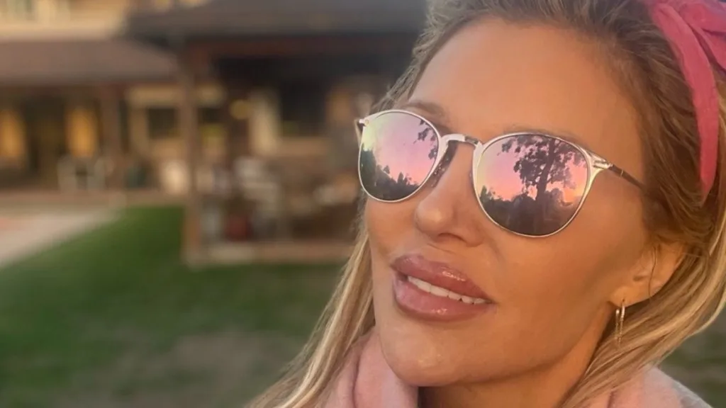 Brandi Glanville suffers chemical burns after using Nair to kill facial parasite