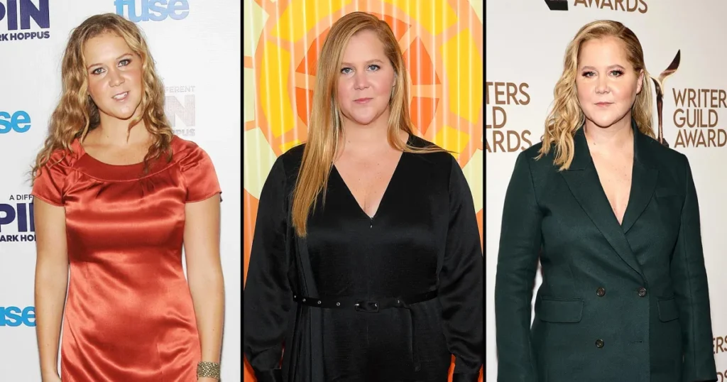 Amy Schumer stuns fans with dramatic weight loss transformation RHONJ alum says “Legs for days and confidence for miles…”