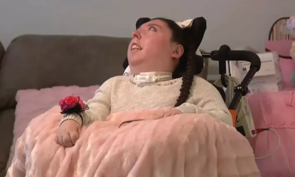 Woman Born Without a Brain Turns 20 — The Miracle Story of Alex Simpson