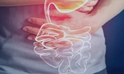 Gastro-specialist-delhi-1024x574