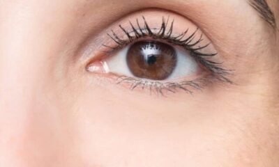 eyelid_surgery_scaled_661ff1c181